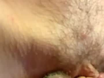 Cam for memberme1c